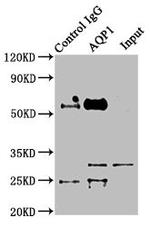 Aquaporin 1 Antibody in Immunoprecipitation (IP)