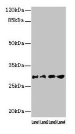 Aquaporin 1 Antibody in Western Blot (WB)