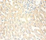 MT1X Antibody in Immunohistochemistry (Paraffin) (IHC (P))