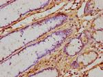 IFN alpha Antibody in Immunohistochemistry (Paraffin) (IHC (P))