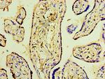 DNAH3 Antibody in Immunohistochemistry (Paraffin) (IHC (P))