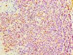 DNAH3 Antibody in Immunohistochemistry (Paraffin) (IHC (P))