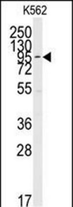 ERK5 Antibody in Western Blot (WB)