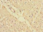 PPM1E Antibody in Immunohistochemistry (Paraffin) (IHC (P))