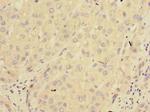 PPM1E Antibody in Immunohistochemistry (Paraffin) (IHC (P))