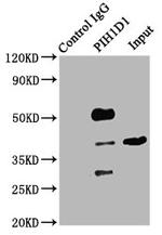 PIH1D1 Antibody in Immunoprecipitation (IP)