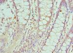 SMC1 Antibody in Immunohistochemistry (Paraffin) (IHC (P))