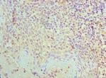 SMC1 Antibody in Immunohistochemistry (Paraffin) (IHC (P))