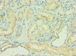 C4BPB Antibody in Immunohistochemistry (Paraffin) (IHC (P))