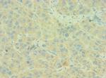 C4BPB Antibody in Immunohistochemistry (Paraffin) (IHC (P))