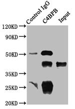 C4BPB Antibody in Immunoprecipitation (IP)