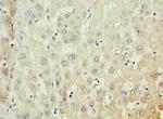 MKS1 Antibody in Immunohistochemistry (Paraffin) (IHC (P))