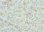 PSME1 Antibody in Immunohistochemistry (Paraffin) (IHC (P))