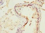 NMT2 Antibody in Immunohistochemistry (Paraffin) (IHC (P))