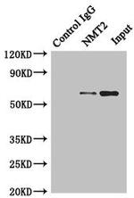 NMT2 Antibody in Immunoprecipitation (IP)