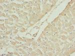 RAC3 Antibody in Immunohistochemistry (Paraffin) (IHC (P))