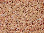 LATS1 Antibody in Immunohistochemistry (Paraffin) (IHC (P))