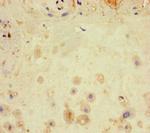 LATS1 Antibody in Immunohistochemistry (Paraffin) (IHC (P))