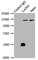 LATS1 Antibody in Immunoprecipitation (IP)