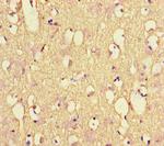 NEFL Antibody in Immunohistochemistry (Paraffin) (IHC (P))