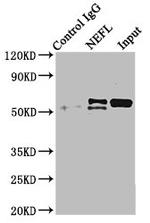 NEFL Antibody in Immunoprecipitation (IP)