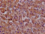 MX1 Antibody in Immunohistochemistry (Paraffin) (IHC (P))