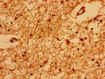 TRNP1 Antibody in Immunohistochemistry (Paraffin) (IHC (P))