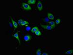 DR4 Antibody in Immunocytochemistry (ICC/IF)