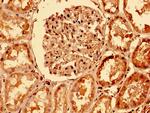 DR4 Antibody in Immunohistochemistry (Paraffin) (IHC (P))