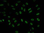 Acetyl-Histone H1.4 (Lys51) Antibody in Immunocytochemistry (ICC/IF)