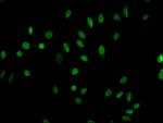 Acetyl-Histone H1.4 (Lys63) Antibody in Immunocytochemistry (ICC/IF)