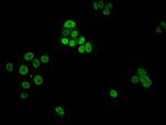 Phospho-Histone H1.4 (Thr3) Antibody in Immunocytochemistry (ICC/IF)