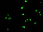 Acetyl-Histone H1.4 (Lys16) Antibody in Immunocytochemistry (ICC/IF)