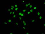 2-hydroxyisobutyryl-Histone H1.2 (Lys63) Antibody in Immunocytochemistry (ICC/IF)