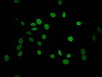 Mono-methyl-Histone H1.2 (Lys118) Antibody in Immunocytochemistry (ICC/IF)