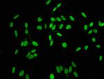 Phospho-Histone H1.2 (Thr164) Antibody in Immunocytochemistry (ICC/IF)