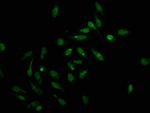 Formyl-Histone H1.2 (Lys159) Antibody in Immunocytochemistry (ICC/IF)