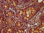 ZIC5 Antibody in Immunohistochemistry (Paraffin) (IHC (P))