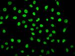 2-hydroxyisobutyryl-Histone H1.2 (Lys25) Antibody in Immunocytochemistry (ICC/IF)