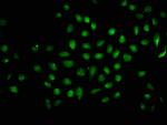 2-hydroxyisobutyryl-Histone H1.2 (Lys116) Antibody in Immunocytochemistry (ICC/IF)