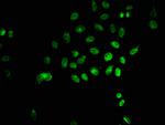 2-hydroxyisobutyryl-Histone H1.2 (Lys135) Antibody in Immunocytochemistry (ICC/IF)