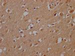 OR10A2 Antibody in Immunohistochemistry (Paraffin) (IHC (P))