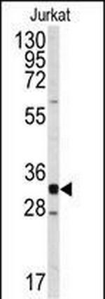 CDK2 Antibody in Western Blot (WB)