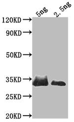 SNF1 Antibody in Western Blot (WB)