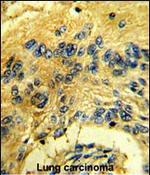 CDK3 Antibody in Immunohistochemistry (Paraffin) (IHC (P))