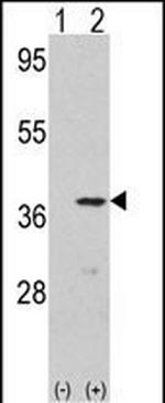 CDK3 Antibody in Western Blot (WB)