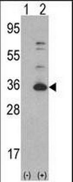 CDK4 Antibody in Western Blot (WB)