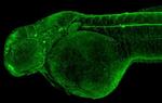 alpha Tubulin Antibody in Immunohistochemistry (IHC)