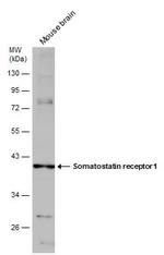 SSTR1 Antibody in Western Blot (WB)