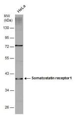 SSTR1 Antibody in Western Blot (WB)